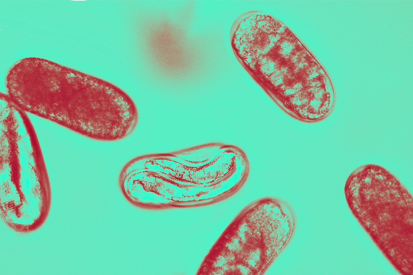 soybean cyst nematode eggs under microscope